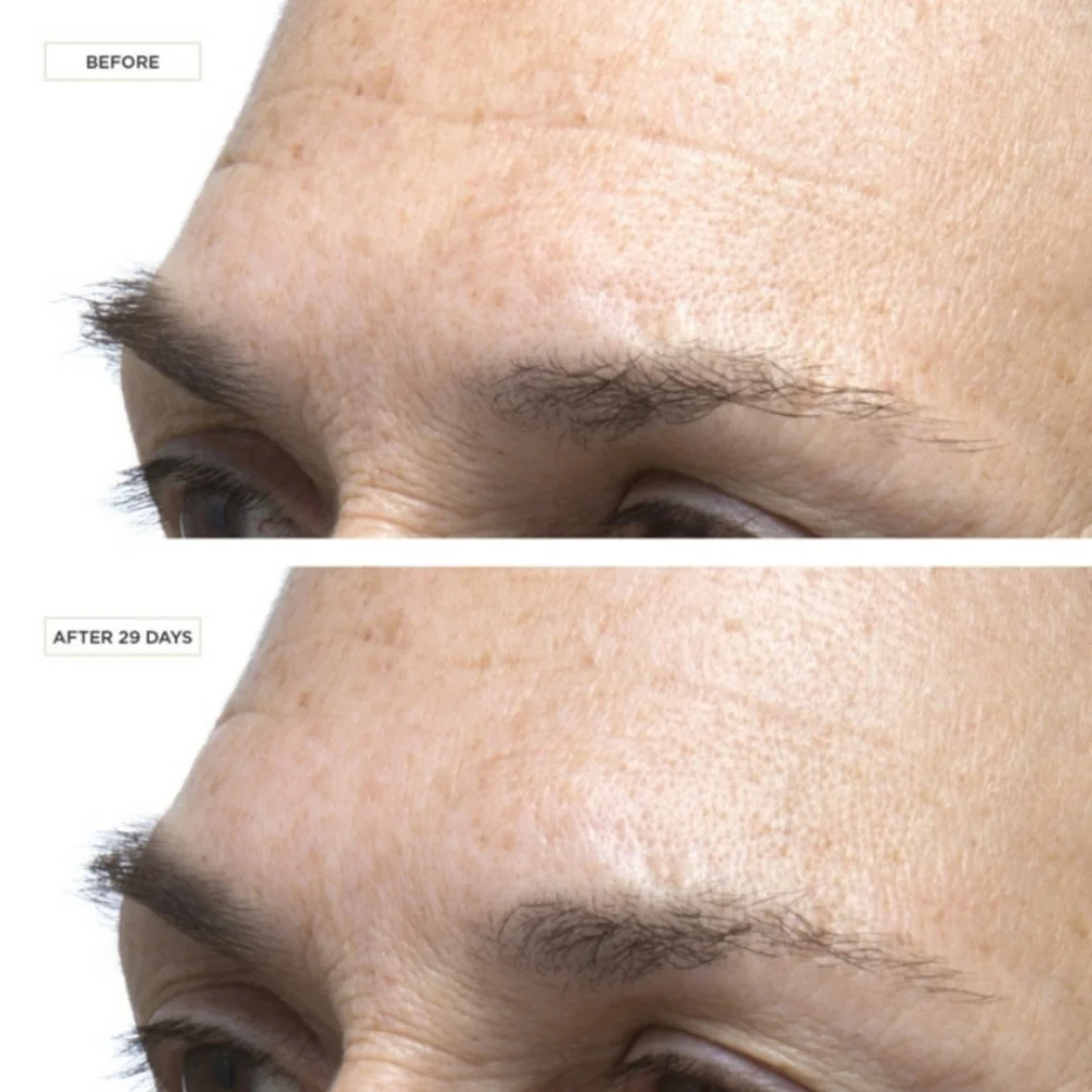 PERRICONE MD COLD PLASMA+ FACE ADVANCED CONCENTRAT - Picture 3 of 5